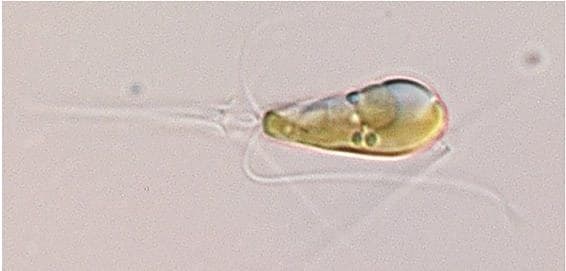 A microscope image of a single-celled alga